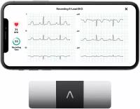 Беспроводной мобильный ЭКГ-монитор AliveCor KardiaMobile 6L