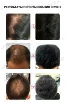 Sevich / Севич Загуститель для волос - рассыпчатый камуфляж седины и выпадения, средство для укладки, dark brown (темно-коричневый), 25 г