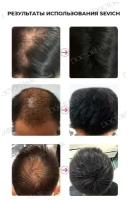 Sevich (Севич) Загуститель для волос - рассыпчатый камуфляж седины и выпадения, средство для укладки, (средне-коричневый), 25 г