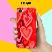 Силиконовый чехол на LG Q6 TOP 30