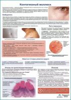 Контагиозный моллюск медицинский плакат, глянцевая фотобумага от 200 г/кв. м, размер A1+