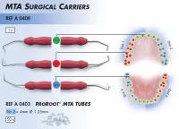 MTA Surgiacal Carriers №0/0, 1/3, 2/4 (зеленый, красный синий) Плаггеры в наборе для внесения MTA в каналы зубов компл/3 плаггера и 50 трубочек