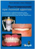 Протезирование при полной адентии. Клинические и зуботехнические этапы изготовления съемных полных протезов по модифицированному методу Лаурицена