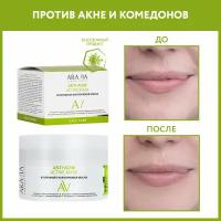 ARAVIA Anti-Acne Active Mask Хлорофилл-каротиновая маска