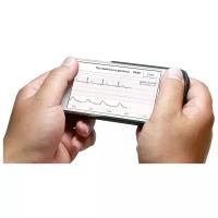 Модуль электрокардиографа CardioQVARK для iPhone 5/5s/SE