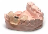 Фотополимер HARZ LABS Dental Pink для 3D принтеров LCD/DLP