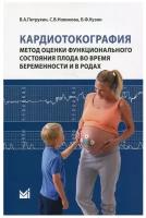 Кардиотокография. Метод оценки функционального состояния плода во время беременности и в родах