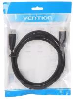 Vention DP Male to Male Cable 2M Cotton Braided Black